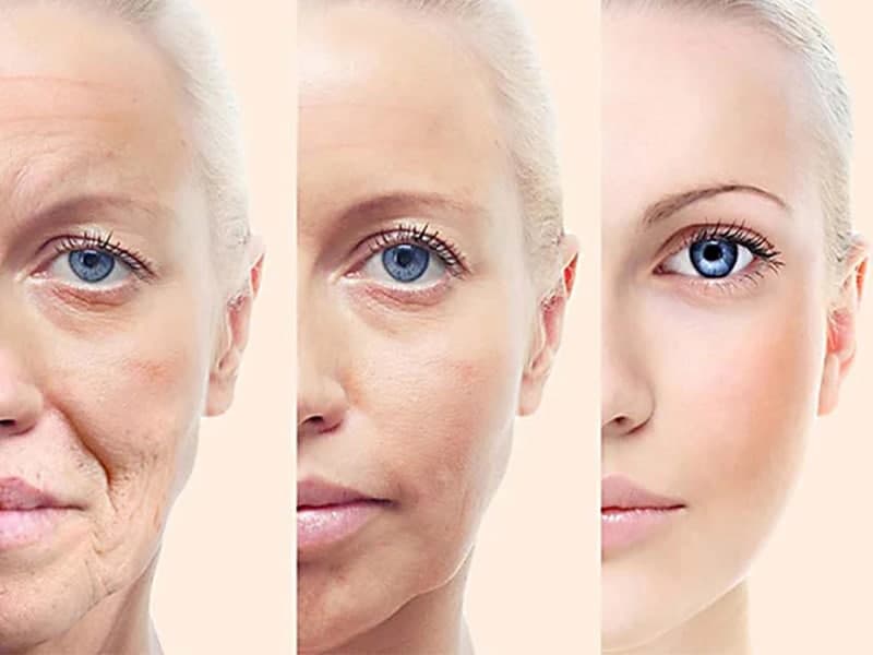 امپول جوان سازی پوست |بهترین روش جوانسازی پوست نی نی سایت |بهترین و سریعترین روش برای جوانسازی و سفتی پوست صورت
