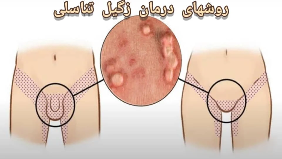 عمومی