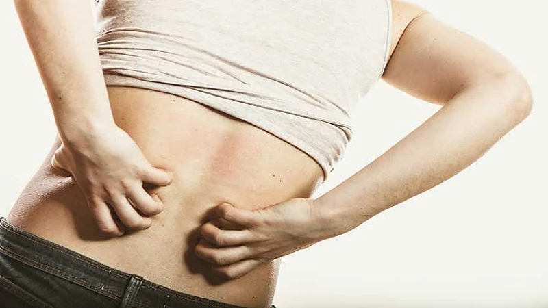 The cause of skin irritation after lipomatic