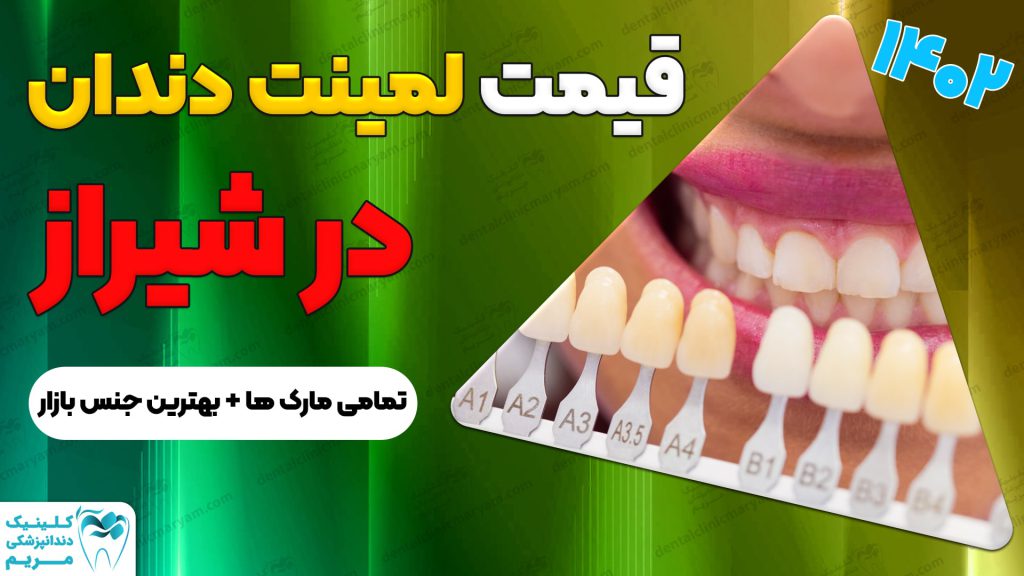 بهترین دکتر برای لمینت دندان در شیراز نی نی سایت |قیمت کامپوزیت دندان در شیراز |قیمت لمینت دندان در شیراز ۱۴۰۰