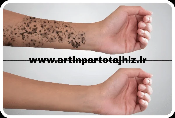 پاک کردن تاتو و خالکوبی