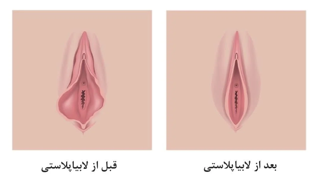 عمومی