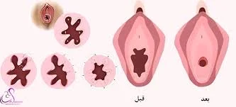 عمومی