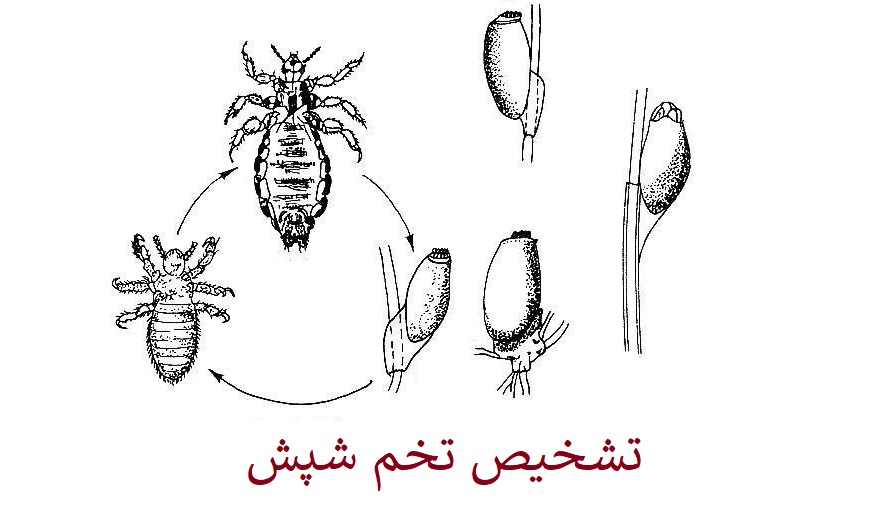 تخم شپش چه شکلیه؟