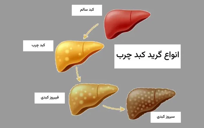 بیماری |تغذیه بیماری |تغذیه
